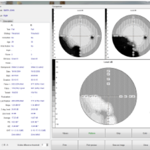 FREY Visual Field Analyzer - Perimetry Test Result