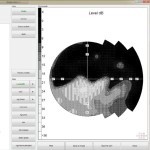 FREY Visual Field Analyzer - Perimetry Test ResultFrey visual field analyzer AP 300 Pattern calibration